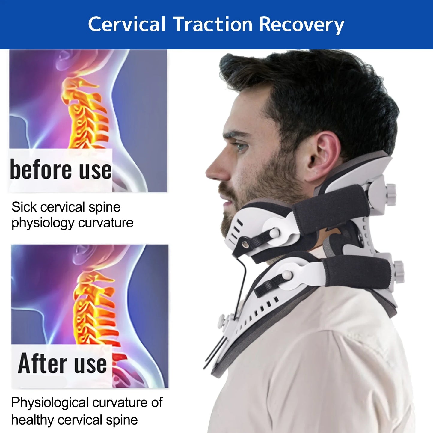Neck Brace Support Orthosis